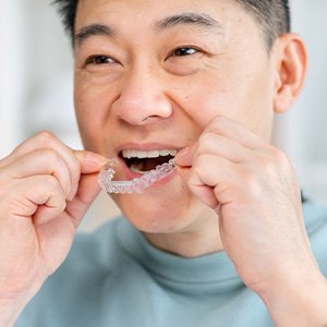 Patient putting on clear aligner