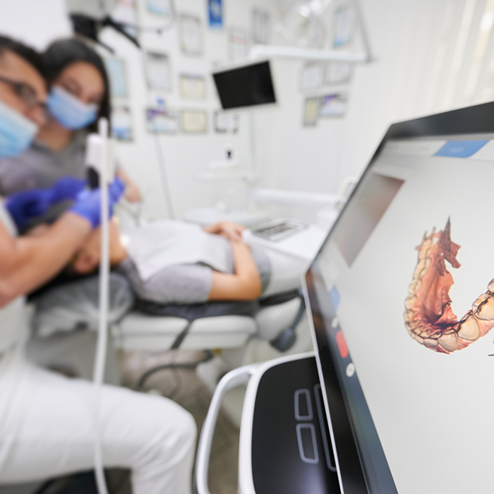 Screen in dental treatment room showing a digital model of a row of teeth